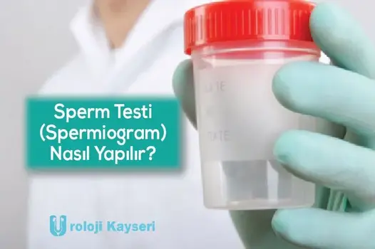 Sperm Testi (Spermiogram) Nasıl Yapılır?